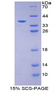 Recombinant Insulin (INS)