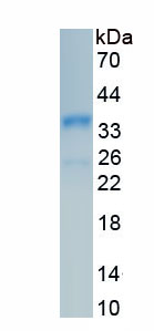 Recombinant Insulin (INS)