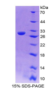 Recombinant Kallikrein 4 (KLK4)