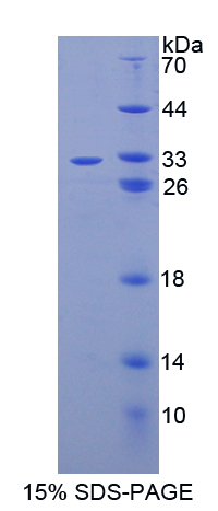 Recombinant Caspase 14 (CASP14)