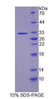 Recombinant Caspase 14 (CASP14)