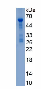 Recombinant Mineralocorticoid Receptor (MR)