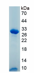 Recombinant Lipase, Endothelial (LIPG)