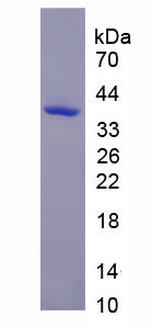 Recombinant Osteocalcin (OC)