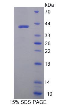 Recombinant Osteocalcin (OC)