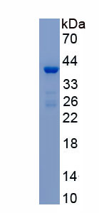 Recombinant Cystatin A (CSTA)