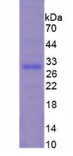 Recombinant Cardiac Troponin I (cTnI)