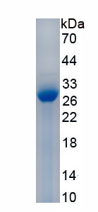 Recombinant Cardiac Troponin I (cTnI)