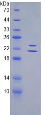 Recombinant Endothelin 1 (EDN1)