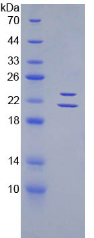Recombinant Endothelin 1 (EDN1)