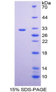 Recombinant Endothelin Converting Enzyme 1 (ECE1)