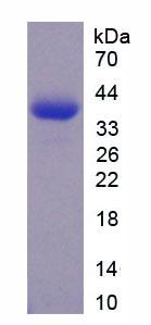 Recombinant N-Terminal Pro-Brain Natriuretic Peptide (NT-ProBNP)