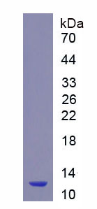 Recombinant N-Terminal Pro-Brain Natriuretic Peptide (NT-ProBNP)