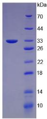 Recombinant Cytokeratin 5 (CK5)