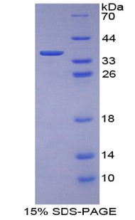 Recombinant Cytokeratin 1 (CK1)