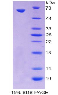 Recombinant Protein Kinase C Theta (PKCq)