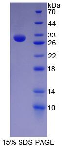 Recombinant Nestin (NES)