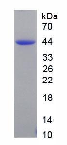 Recombinant Natriuretic Peptide Precursor B (NPPB)