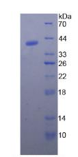 Recombinant Natriuretic Peptide Precursor B (NPPB)