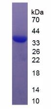 Recombinant Serum Response Factor (SRF)