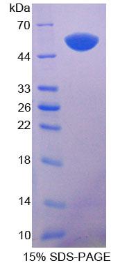 Recombinant Cytokeratin 14 (CK14)