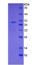 Recombinant Tissue Factor (TF)