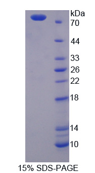 Recombinant Tissue Plasminogen Activator (tPA)