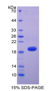 Recombinant Thrombomodulin (TM)