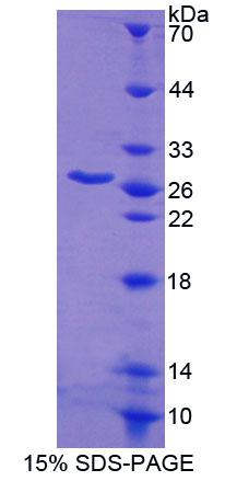 Recombinant Plasminogen Activator Inhibitor 1 (PAI1)