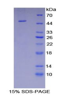 Recombinant Enolase, Neuron Specific (NSE)