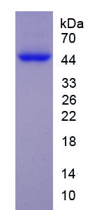 Recombinant Enolase, Neuron Specific (NSE)