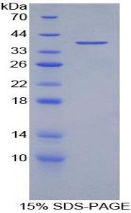 Recombinant Myelin Basic Protein (MBP)