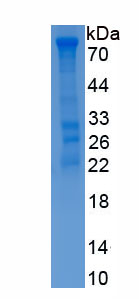 Recombinant Immunoglobulin M (IgM)