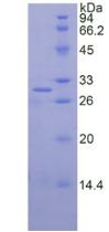 Recombinant Vascular Cell Adhesion Molecule 1 (VCAM1)