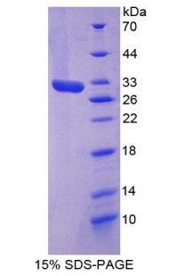 Recombinant Vascular Cell Adhesion Molecule 1 (VCAM1)