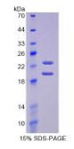 Recombinant Fibroblast Growth Factor 2, Basic (FGF2)
