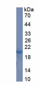 Recombinant Fibroblast Growth Factor 2, Basic (FGF2)