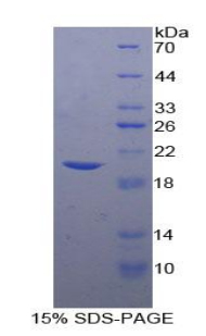 Recombinant Tissue Inhibitors Of Metalloproteinase 1 (TIMP1)