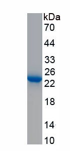 Recombinant Tissue Inhibitors Of Metalloproteinase 1 (TIMP1)