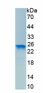 Recombinant Tissue Inhibitors Of Metalloproteinase 1 (TIMP1)