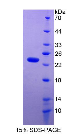 Recombinant Tissue Inhibitors Of Metalloproteinase 1 (TIMP1)