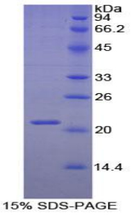 Recombinant Tissue Inhibitors Of Metalloproteinase 1 (TIMP1)