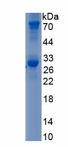 Recombinant Nicotinamide Adenine Dinucleotide Phosphate Oxidase 1 (NOX1)