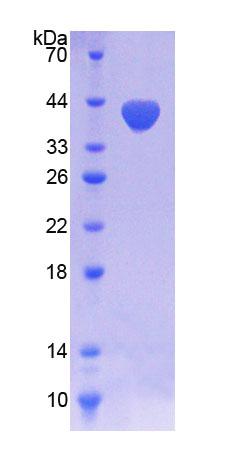 Recombinant Nicotinamide Adenine Dinucleotide Phosphate Oxidase 5 (NOX5)