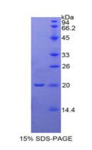 Recombinant Thyroid Peroxidase (TPO)