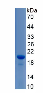 Recombinant Thyroid Peroxidase (TPO)