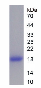 Recombinant Fatty Acid Binding Protein 2, Intestinal (FABP2)