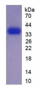 Recombinant Epidermal Growth Factor (EGF)