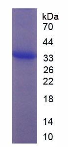 Recombinant Epidermal Growth Factor (EGF)