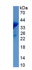 Recombinant Epidermal Growth Factor (EGF)